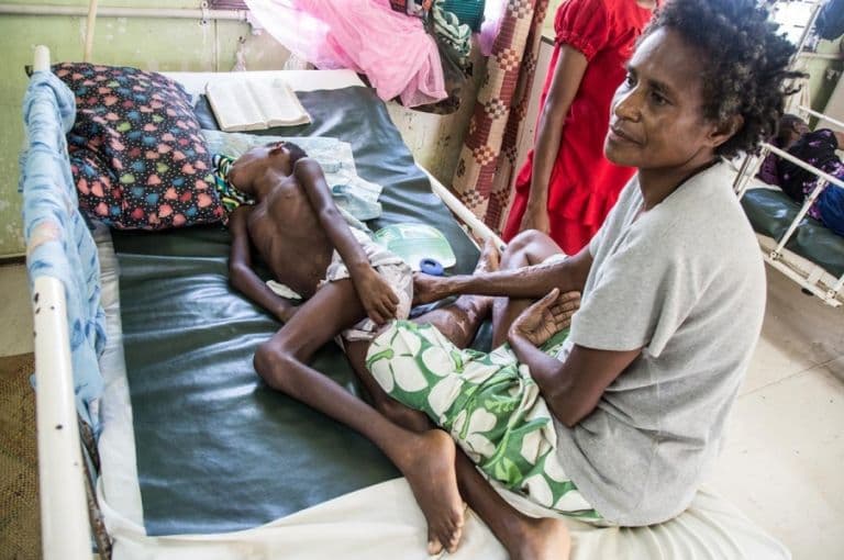 APEC summit will not transform PNG as supporters claim