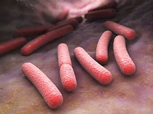Microbiology: why modern life is bad for your gut